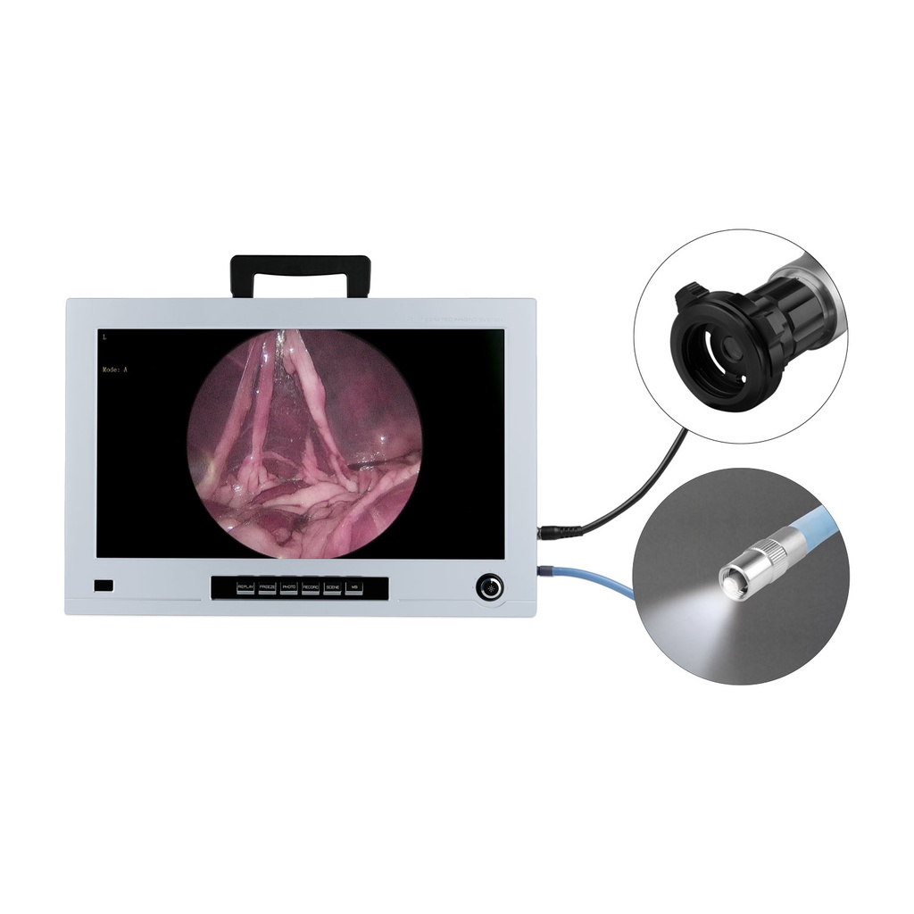 [DK]Monitor til endoskopi, EickView 4 i 1